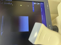 Aparat usg GE Logiq F6