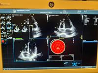 Echokardiograf GE Vivid S70