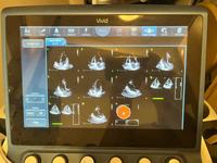 Echokardiograf GE Vivid S70