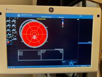 Echokardiograf GE Vivid S70